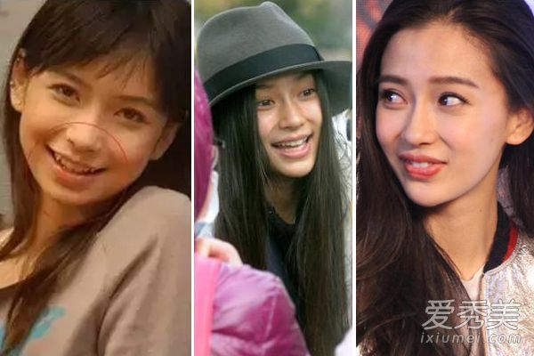 宝贝，杨蜜，郑爽和戚薇把他们尖下巴的面部价值增加了一倍