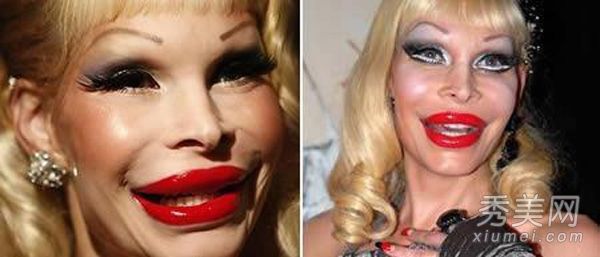 图显示20个最可怕的女性整形失败案例