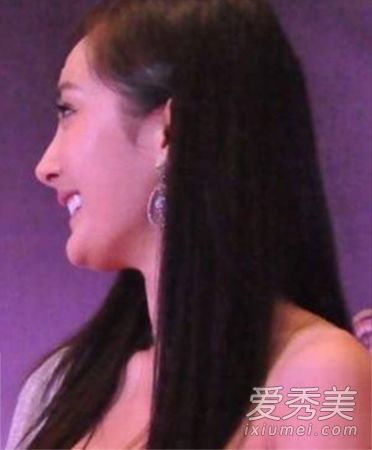 “假脸”从下巴垫+隆鼻+双眼皮切口开始,一秒钟就能看穿