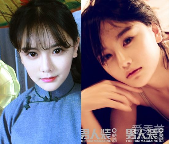 整容失败后“南生女孩”变成蛇脸(照片)