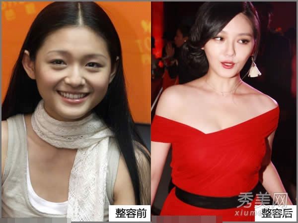 肖强、孙菲菲和李小璐女演员对整容手术的疑虑变成了扭曲的脸