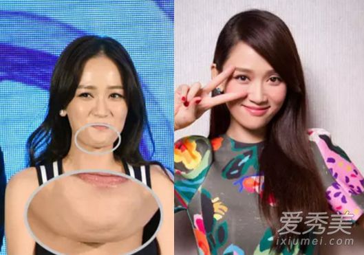 双下巴让你看起来老了5岁，每天10次去除双下巴的动作。