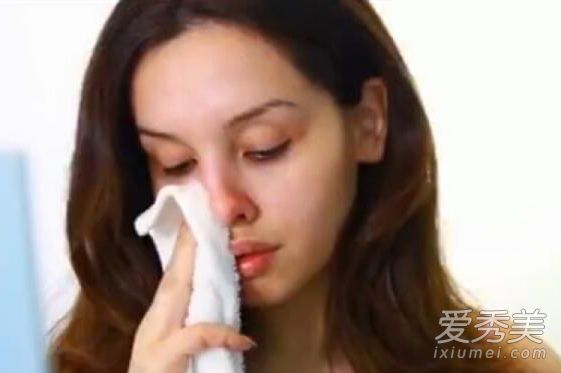 省钱而不伤皮肤，教你如何去黑头而不留下坑。