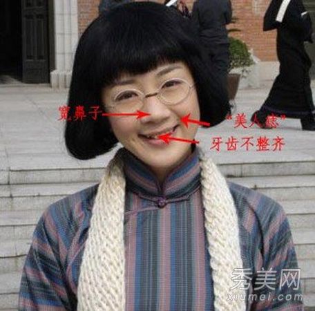 图为《新洛神》中李依晓五个整形手术的对比