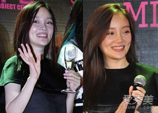 赵，15个最丑的不化妆女演员，皮肤很差。