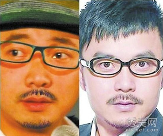 吴春红和王涵成为明星面对面整形手术还是出生？