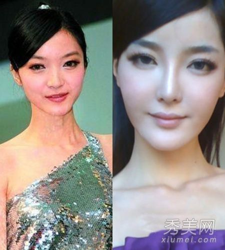 叶一茜·郑爽透露最新疯狂整容女演员