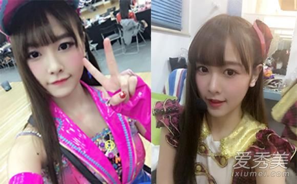 唐80%的烧伤怎么能不留下烧伤后的疤痕？