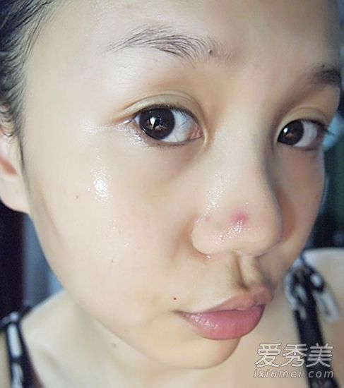 鼻鼠疫的定位:健康鼠疫的成因及消除鼠疫的方法