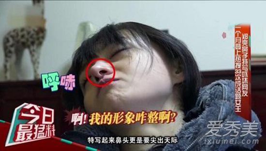 郑爽的隆鼻假体可以追溯到什么时候？白色鼻尖(照片)