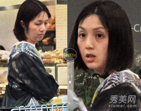 产后皮肤残疾，黑眼圈松弛，在杨千嬅陈瑶猖獗