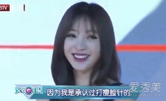 艾达·维恩承认针刺瘦脸的“内幕”