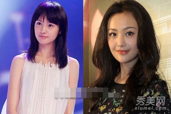 哪些明星整容失败了？