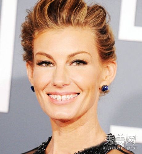 外国巨星的牙齿毁容在牙科整形手术中很流行