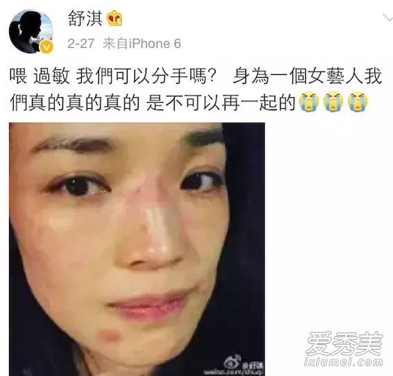 舒淇又过敏了！使用这些化妆品治疗季节性皮肤过敏