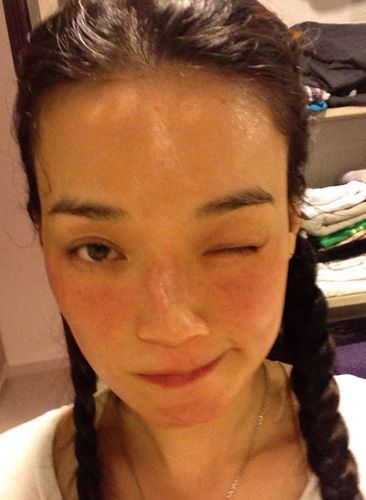 春季皮肤过敏的七个原因90%是自己造成的！