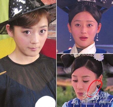 袁姗姗和李依晓新一代女明星成为整形外科的主角