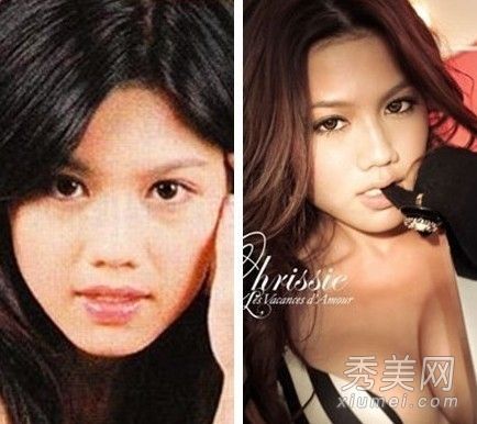 杨蜜与李小璐女演员整容前后的比较