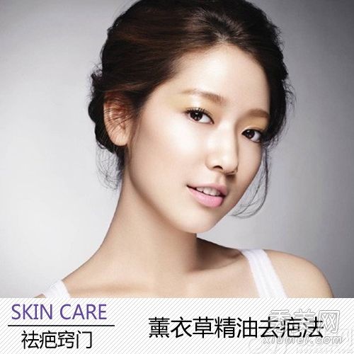 七种纯天然去疤配方