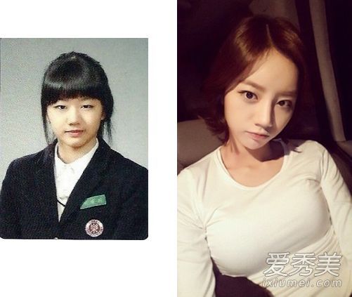 请回答1988年，李惠利不能在整形手术前看！