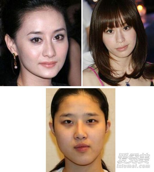 不对称的左右脸怎么样？图形面倾斜校正方法