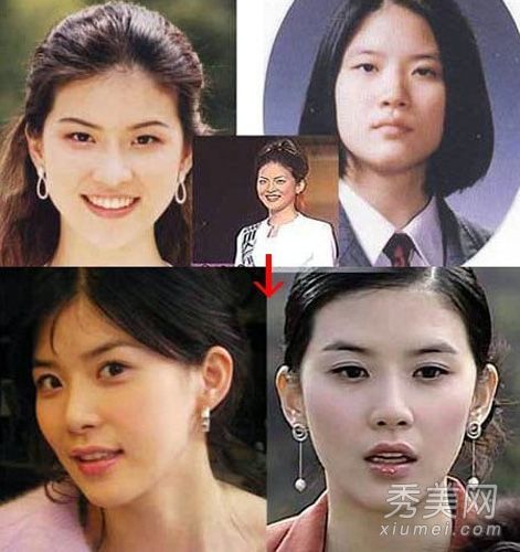 “倾听你的声音”李钟淑李宝英的老照片承认整形手术