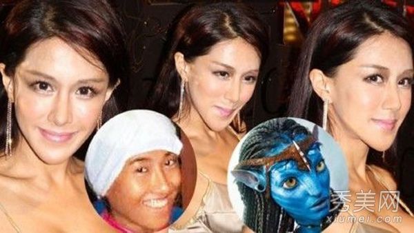 张暖雅未比赛照片揭露整形手术失败