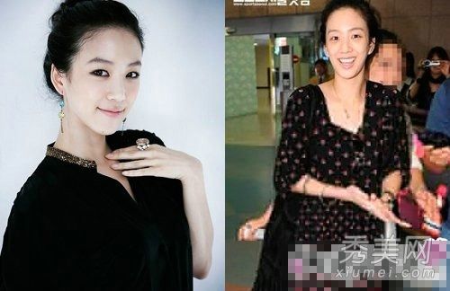 整容失败的中韩娱乐圈女明星(照片)