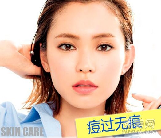 快速去除粉刺不留痕迹苹果酸奶7移动到粉刺痕迹