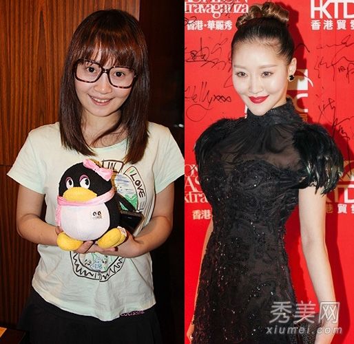 “好声音”徐海星的重复整形手术+2年的愚蠢